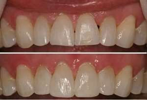 Is Cosmetic Dentistry Worth it