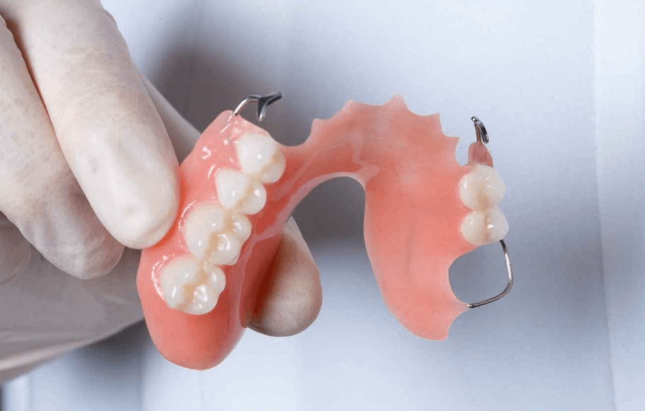 How a General Dentist Can Treat a Cavity